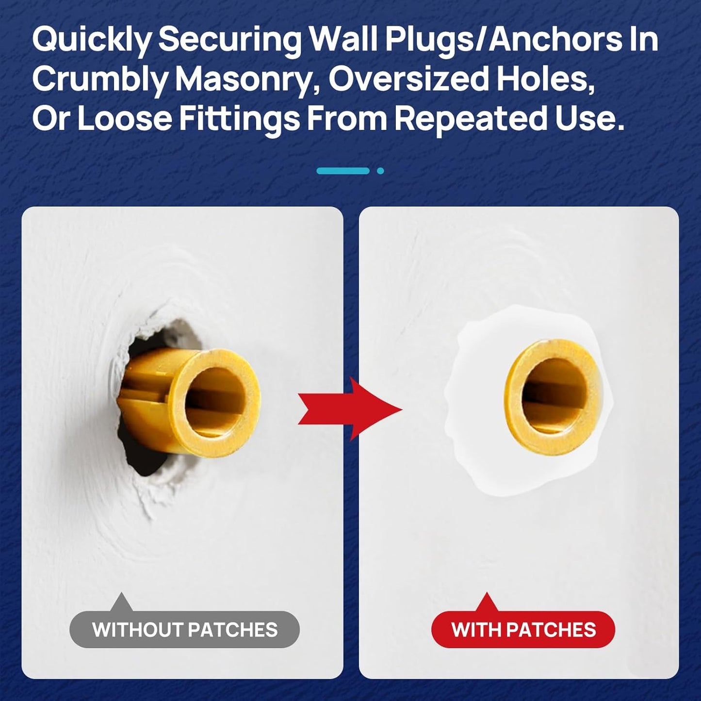 WRAPNLOCK Drywall Anchor Repair Kit - Fast Loose Anchor Fix (No Fill/Redrill) - 22 Patches + Screws/Anchors/Screwdriver/Gloves, Works for Home Fittings